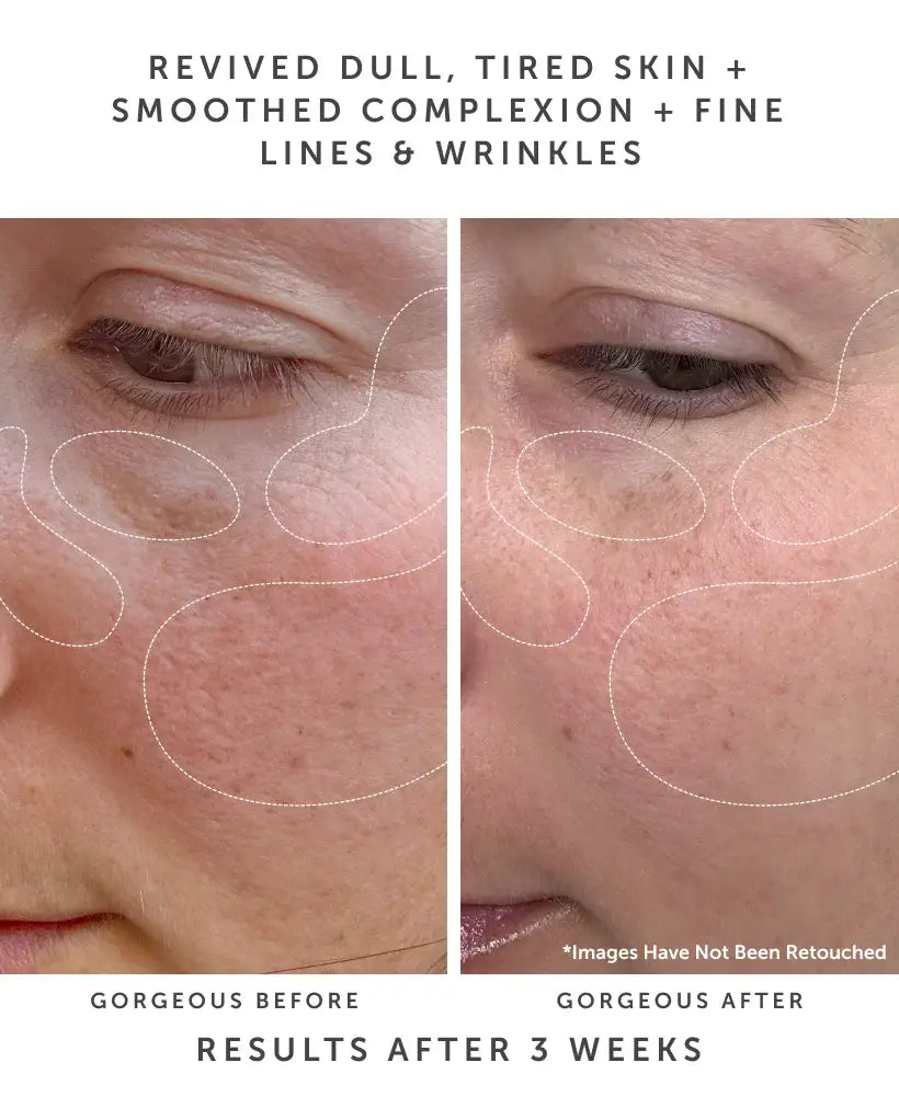 ANCHOR Bio-Retinol Youth Serum: Youthful Treatment